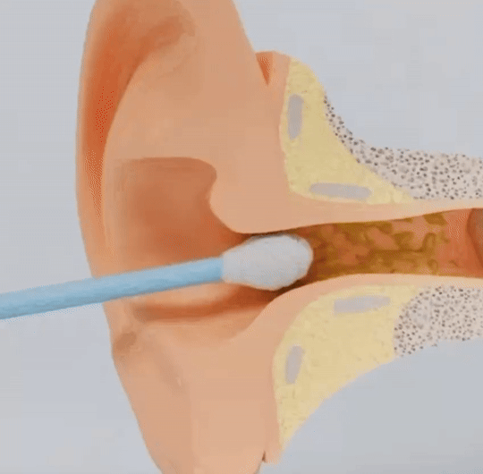 EarView
